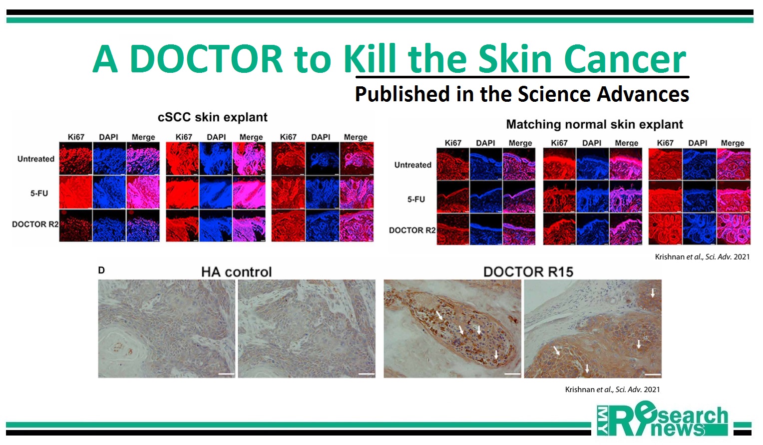 A DOCTOR to Kill the Skin Cancer